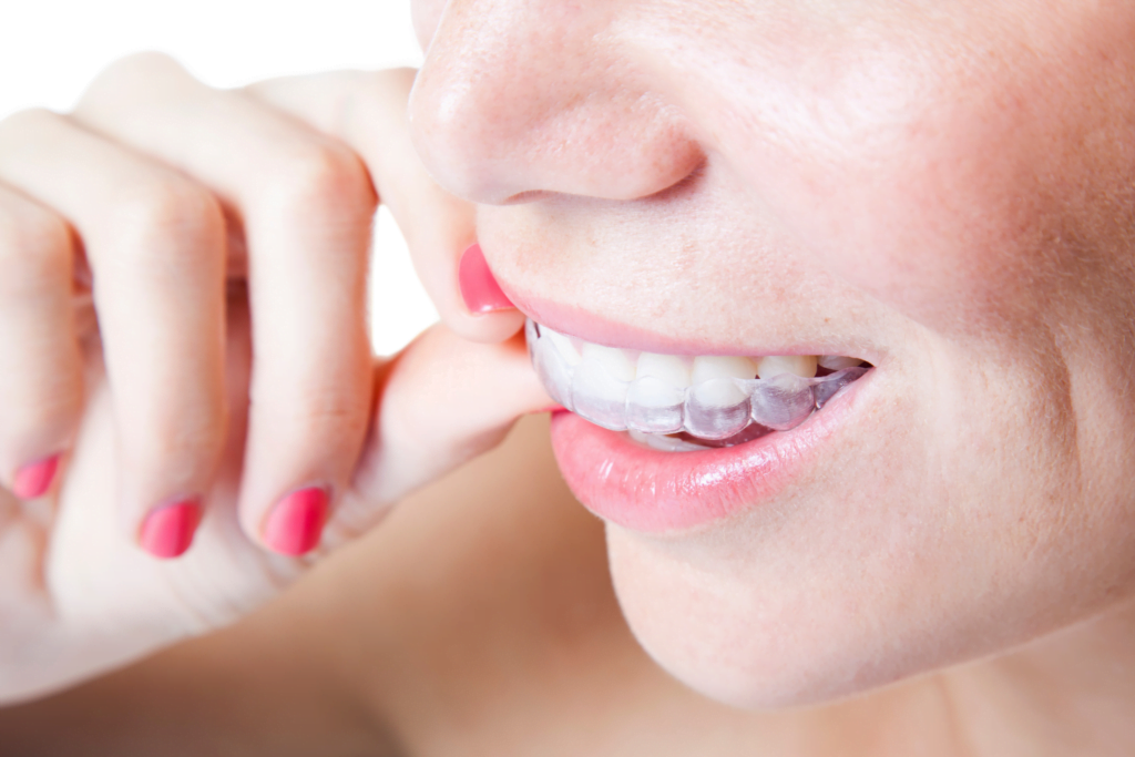 gjennomsiktig tannregulering